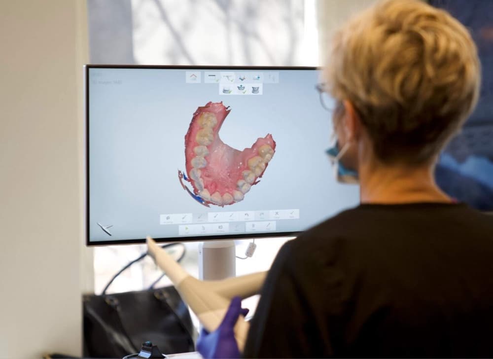 teen getting digital scans taken