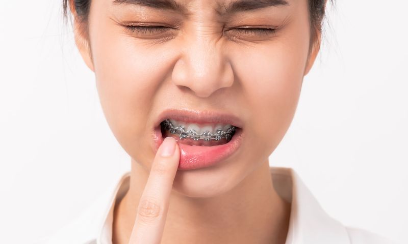 girl wearing braces