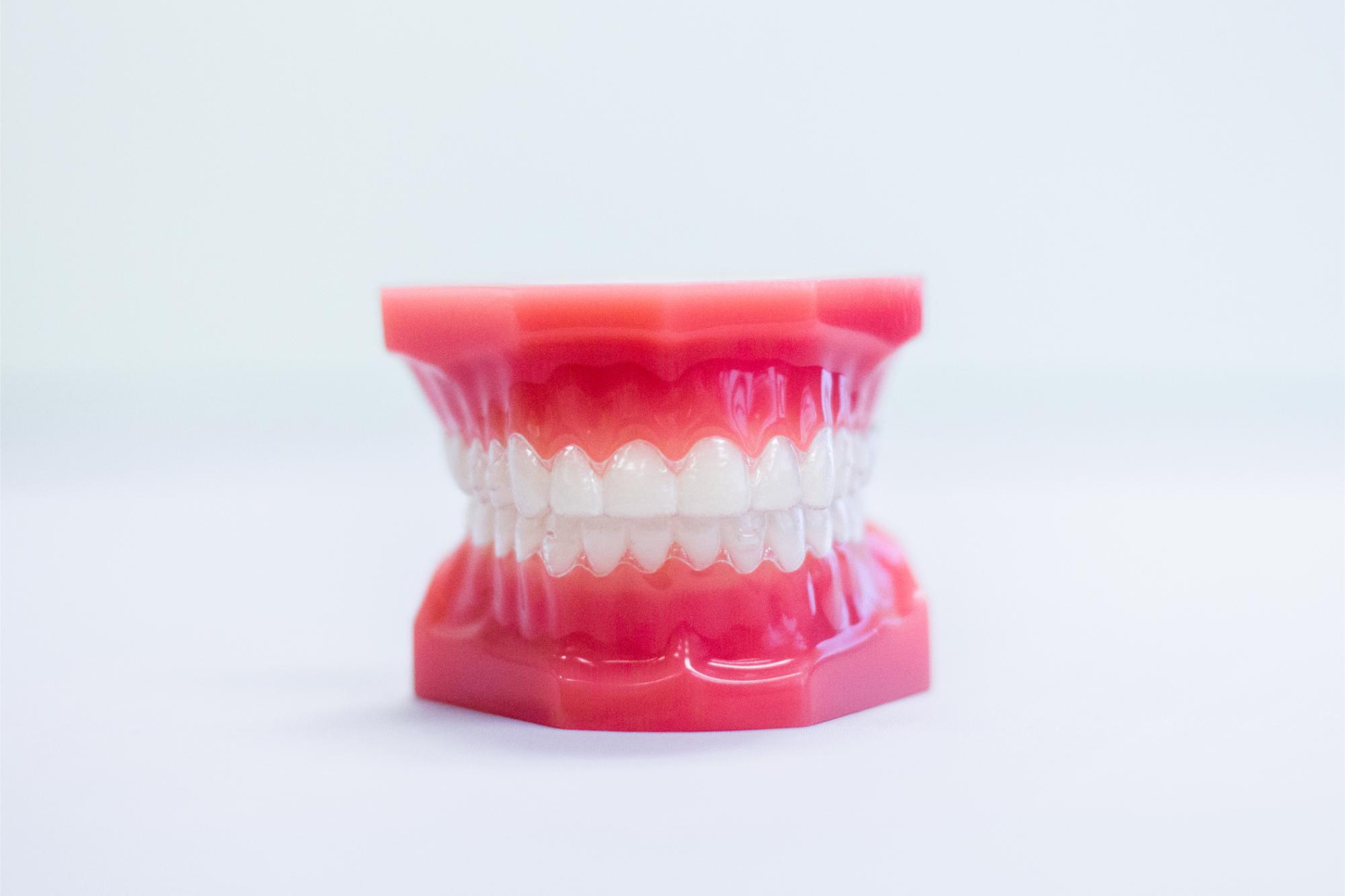invisalign in naperville il
