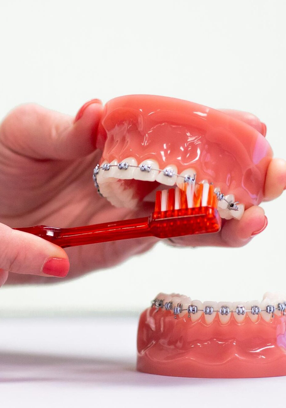 frey orthodontics naperville