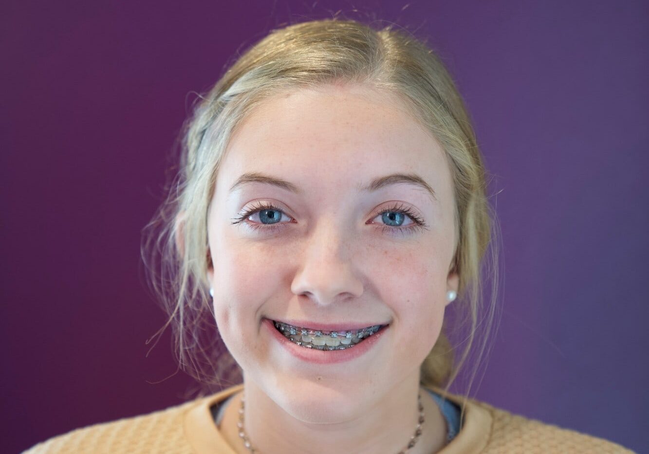 patient with braces